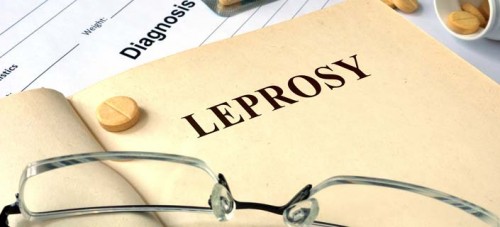 Spread awareness about Leprosy