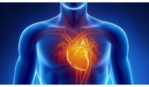 cardiac arrest