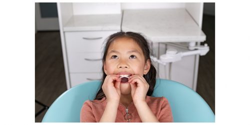 Invisalign_Palatal_Expander_System