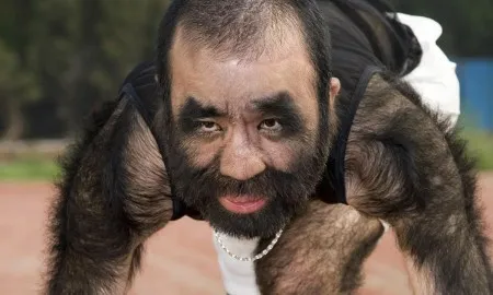 Worlds Hairiest Man Yu Zhenhuan