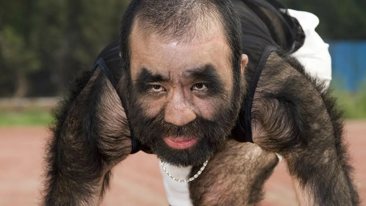 Worlds Hairiest Man Yu Zhenhuan