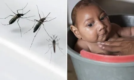 Zika Virus Disease