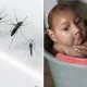 Zika Virus Disease