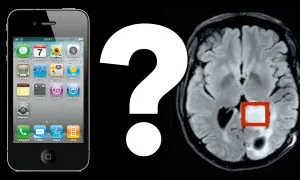 Mobile Phones Cause Brain Cancer