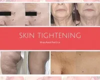 86e90f40db2af72e1b46a2d85c11a757