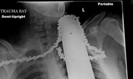 A637a03bc41be21ce08a2399ec757932