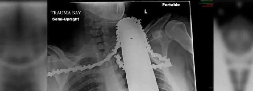 a637a03bc41be21ce08a2399ec757932