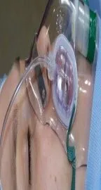 Dd9ce4684bb62fce4c0df36bc0cec0d2