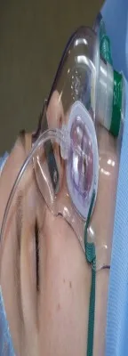 dd9ce4684bb62fce4c0df36bc0cec0d2