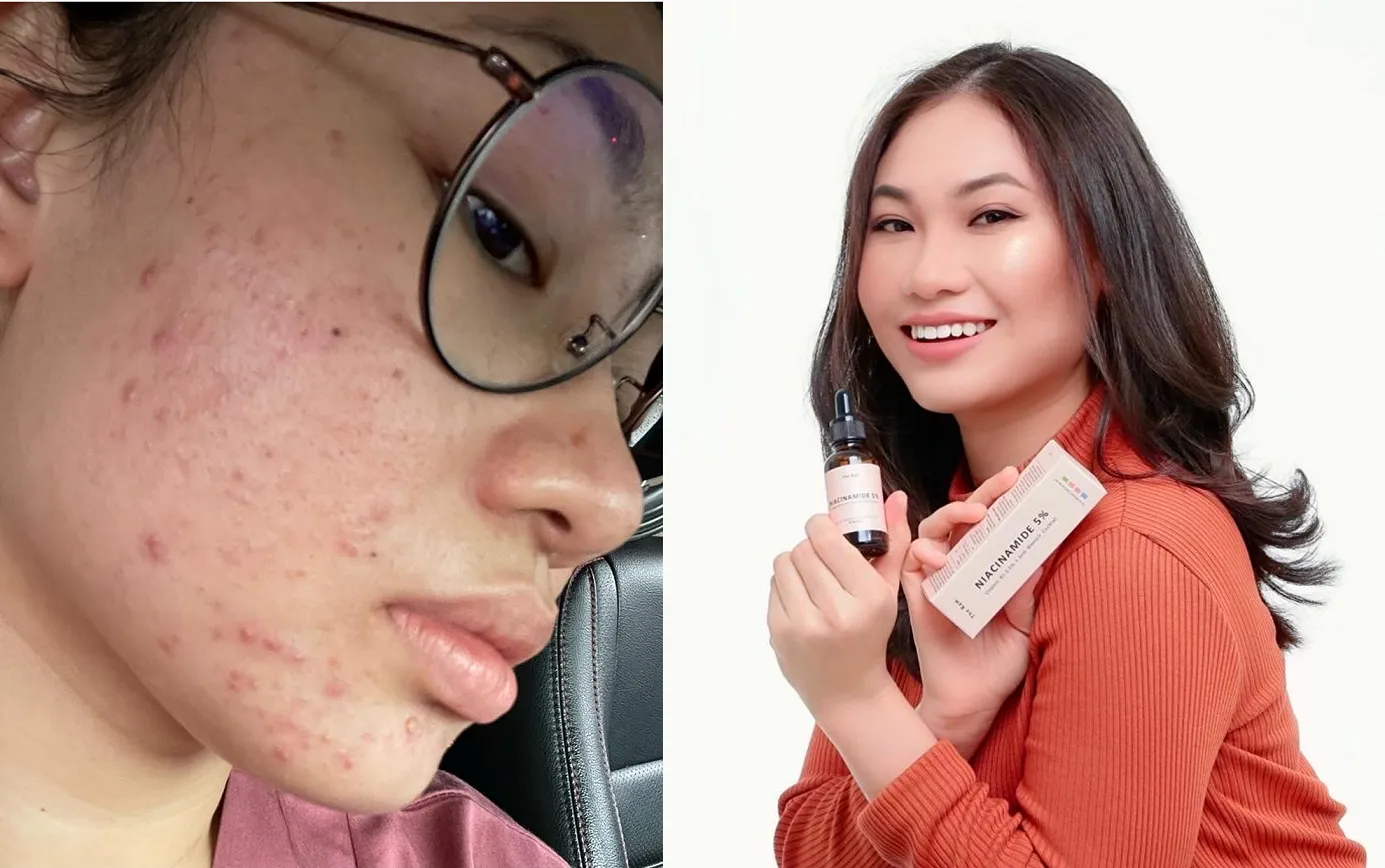 Before-and-after-of-Adibah-Mazla