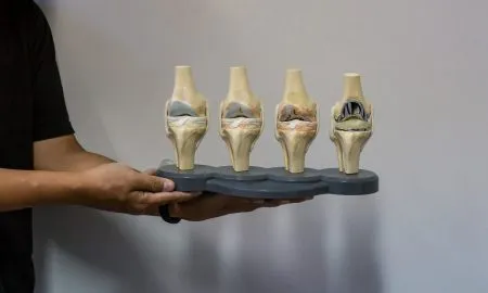 Knee Surgeon In Melbourne