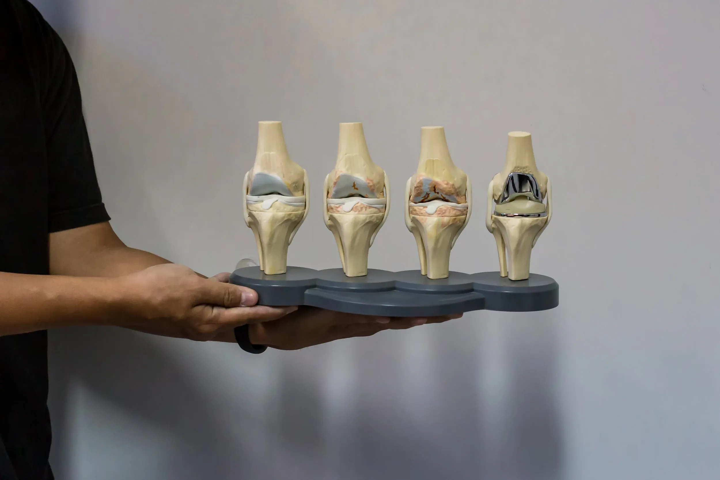 Knee Surgeon In Melbourne