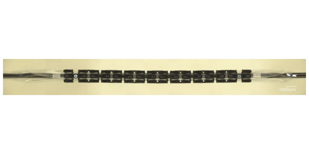 Before_stent_expansion_photo-1
