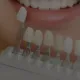 Porcelain Veneers In Florida Cosmetic Dentistry North River Dental