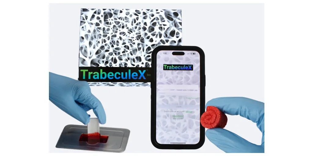TrabeculeX_Continuum_by_Xenco_Medical-1