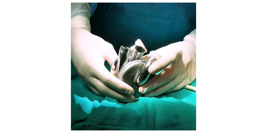 BiVACOR_Total_Artificial_Heart_Surgery-1