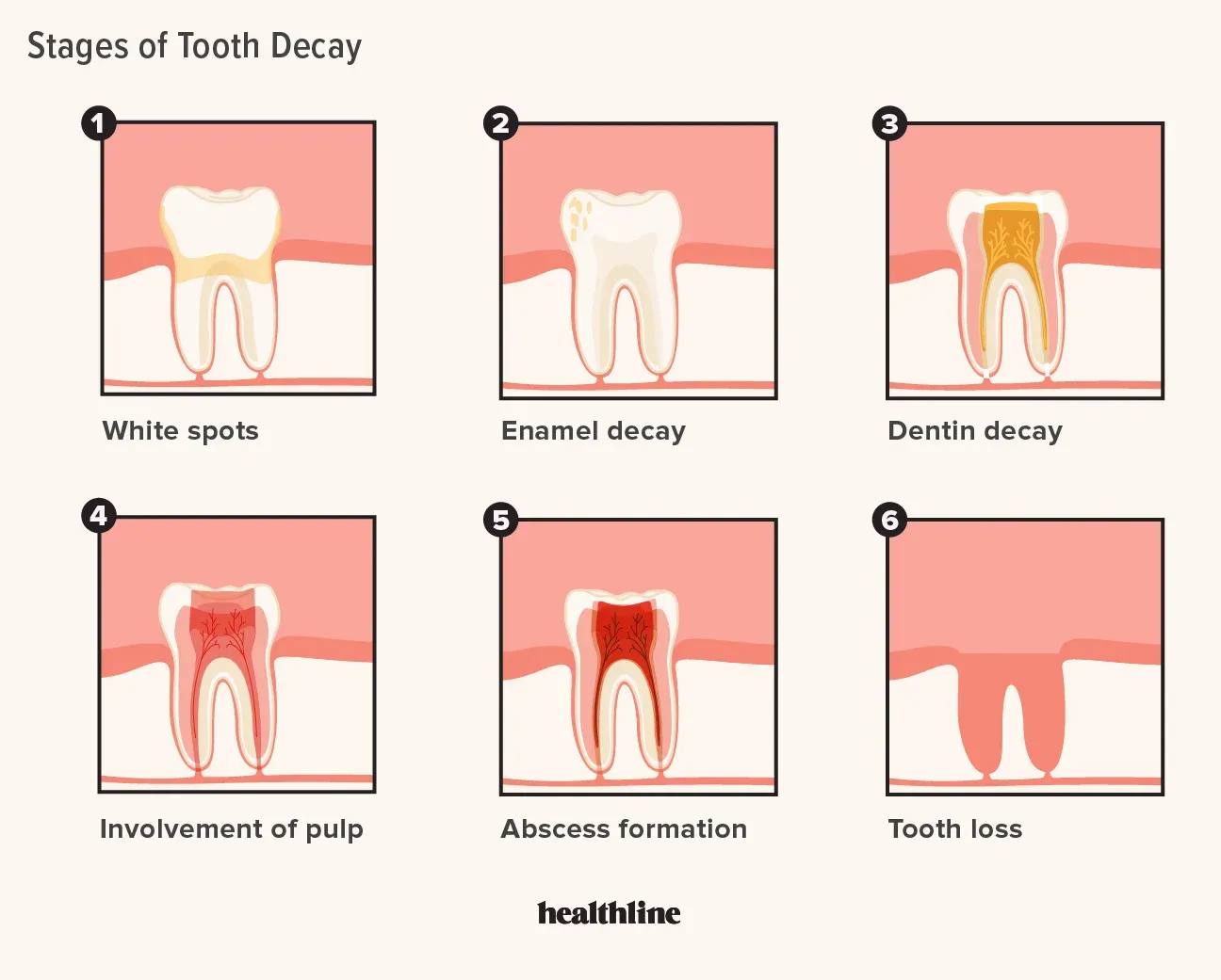 Dental Check-Ups
