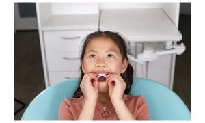 Invisalign Palatal Expander System